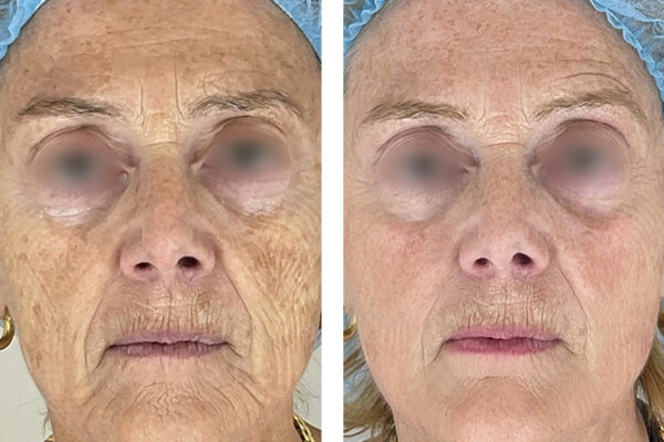 0006_Deka_RedTouchPRO_1