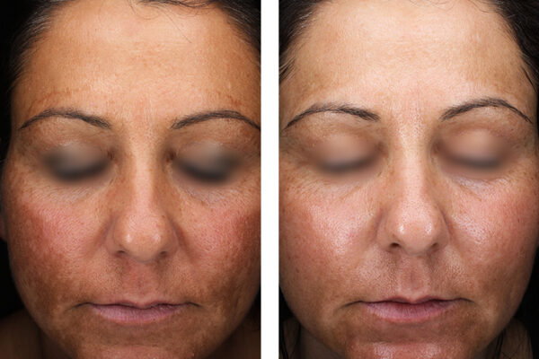 0007_Deka_RedTouchPRO_2