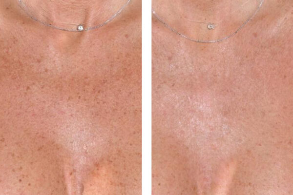 0008_Deka_RedTouchPRO_3